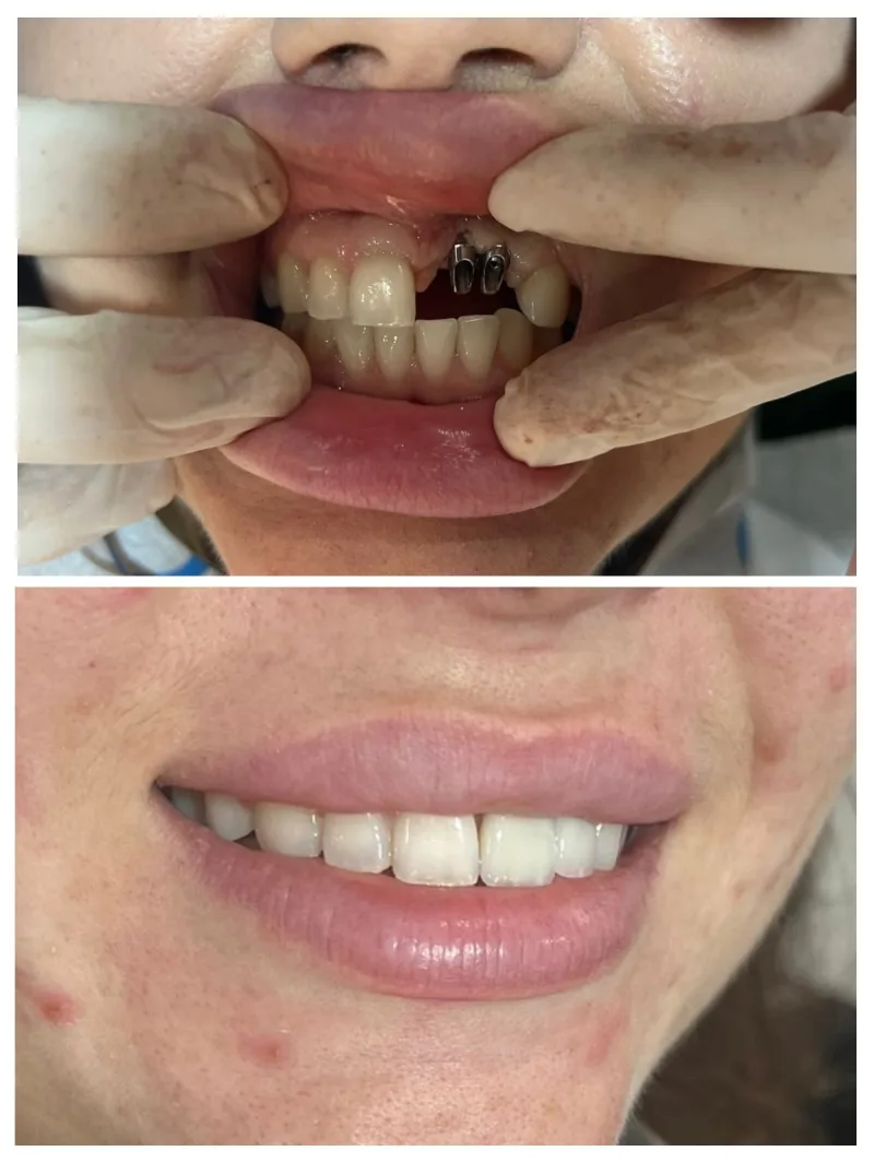 Alanya HEALTHY TEETH Dental Aesthetic — Medicina em Alanya: Encomenda online, preços e comentários